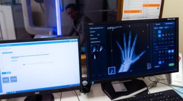 Radiografia Mano