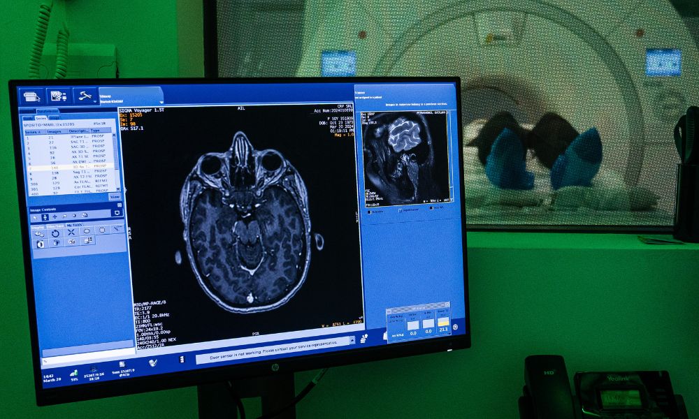Neurologia