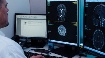 Risonanza Magnetica alla testa