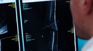 Risonanza alla Colonna Vertebrale