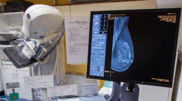 Tecnologia Mammografo